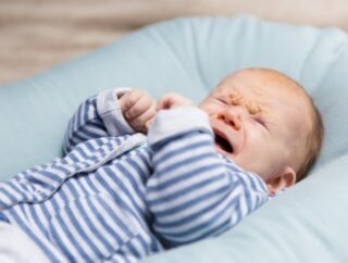 Jak rozpoznać alergię pokarmową u niemowląt i co z nią zrobić?